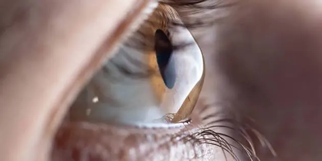 Pterygium Diagnosis & Surgery at Gandhi Eye Centre Faridabad